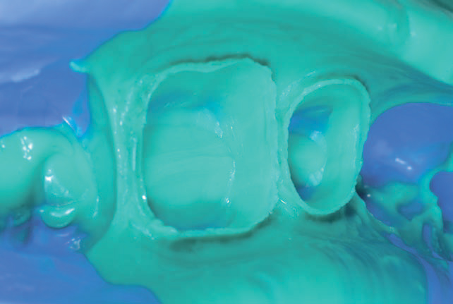 Гидрорайз Регуляр Боди - оттиск